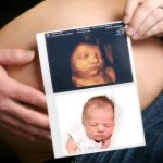 3d-and-4d-sonography-service-500x500